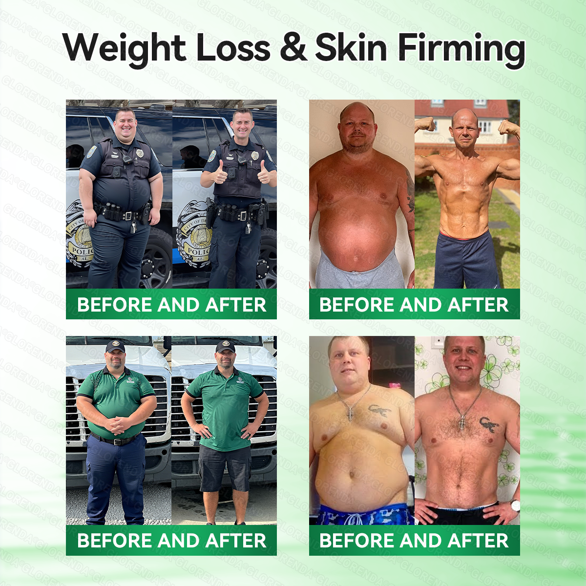 𝑶𝒇𝒇𝒊𝒄𝒊𝒂𝒍 𝑺𝒕𝒐𝒓𝒆  |🔥70%🔥𝐆𝐋𝐎𝑹𝑬𝑵𝑫𝗔®𝑴𝒐𝒓𝒊𝒏𝒈𝗮 · 𝗕𝗲𝗿𝗯𝗲𝗿𝙞𝙣𝙚 × 𝙉𝘼𝐃+ 𝟏𝟎-𝐢𝐧-𝟏 𝗔𝗱𝘃𝗮𝗻𝗰𝙚𝙙 𝙉𝙖𝙣𝙤 𝙈𝙞𝙘𝙧𝙤𝙣𝙚𝙚𝐝𝐥𝐞 𝐏𝐚𝐭𝙘𝙝(𝐉𝐮𝐬𝐭 𝐨𝐧𝐜𝐞 𝐚 𝐝𝐚𝐲, 𝐯𝐢𝐬𝐢𝐛𝐥𝐞 𝐜𝐡𝐚𝐧𝐠𝐞𝐬 𝐢𝐧 𝟕 𝐝𝐚𝐲𝐬） ✅ 𝐅𝐨𝐫 𝐨𝐛𝐞𝐬𝐢𝐭𝐲, 🅛🅞🅞🅢🅔 🅢🅚🅘🅝,𝐝𝐢𝐚𝐛𝐞𝐭𝐞𝐬, 𝐬𝐥𝐞𝐞𝐩 𝐚𝐩𝐧𝐞𝐚, 𝐣𝐨𝐢𝐧𝐭 𝐢𝐬𝐬𝐮𝐞𝐬, 𝐚𝐧𝐝 𝐦𝐨𝐫𝐞 (Copy)